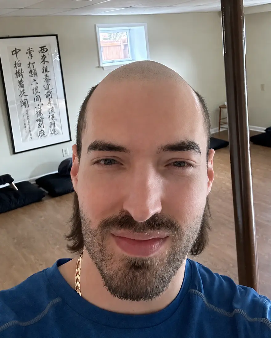 Dr. Zack showing off his skullet hairstyle